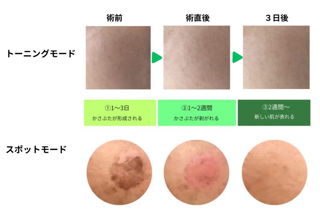 ダウンタイムの違い