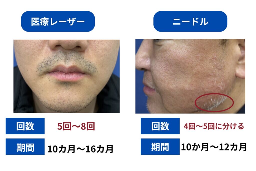 回数と期間