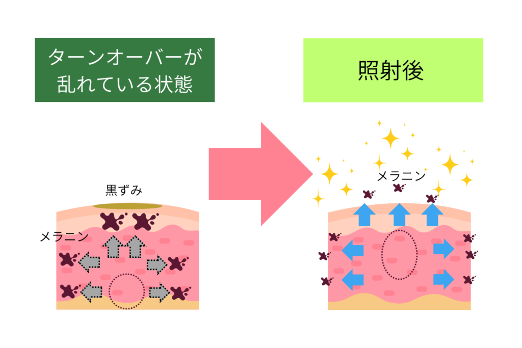 ②肌のターンオーバーを促進