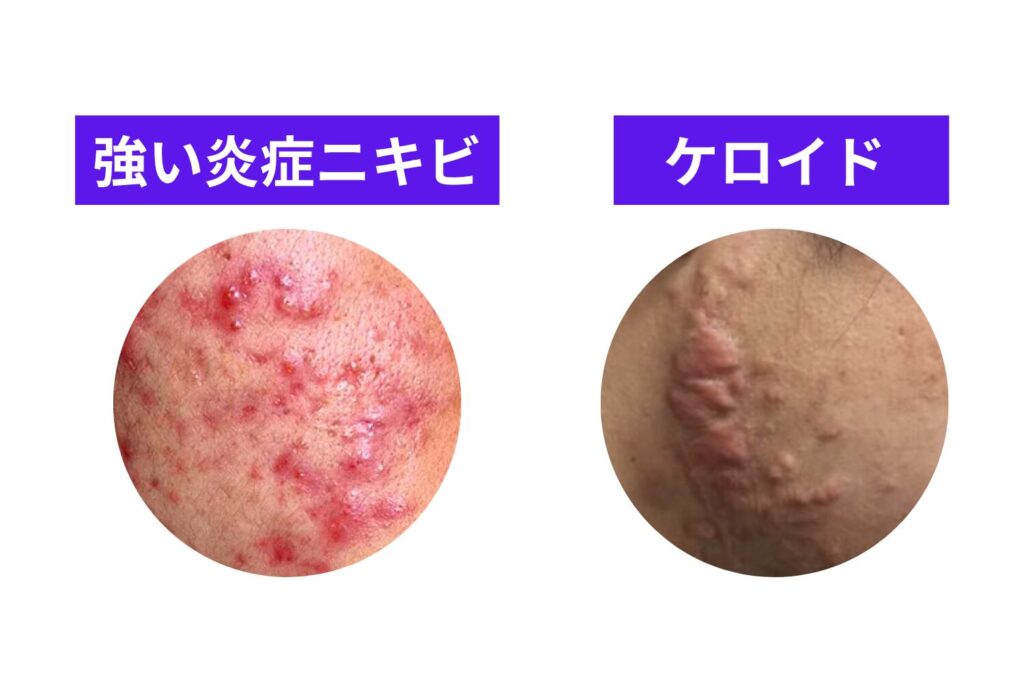肌の炎症や体調によっては施術を受けられない場合がある