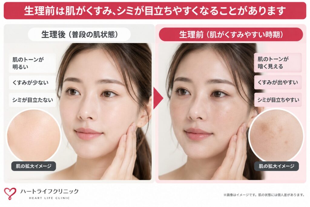 生理後にシミが目立ちにくくなることもある