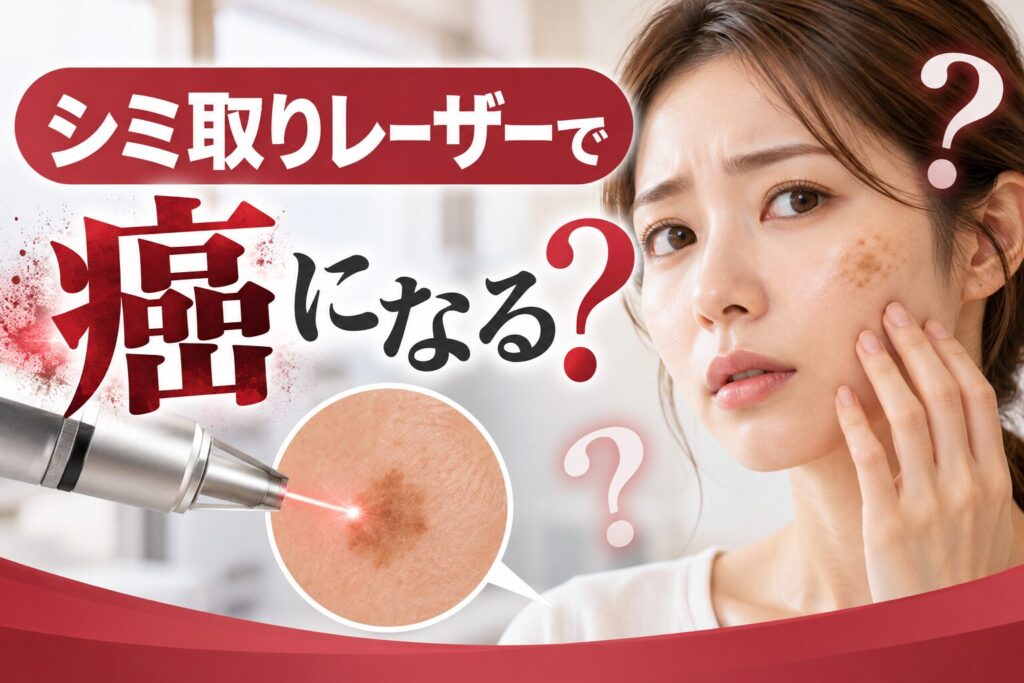 シミ取りレーザーで癌になる?発がん性の有無と「シミに見える皮...
