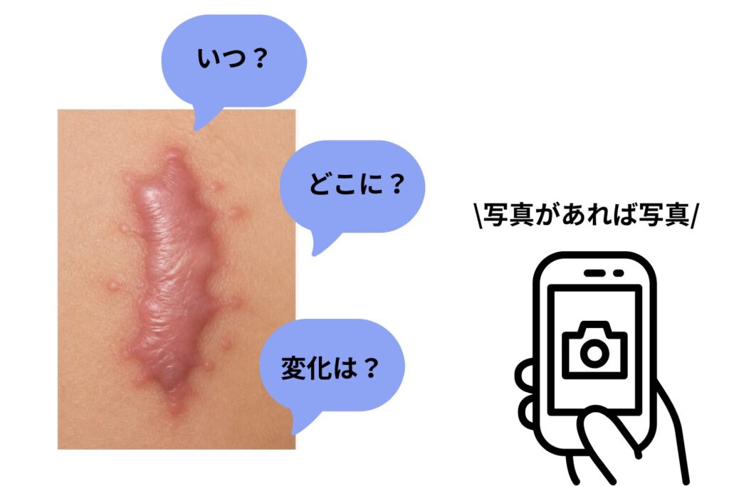 カウンセリングではケロイドの経緯まで伝えましょう