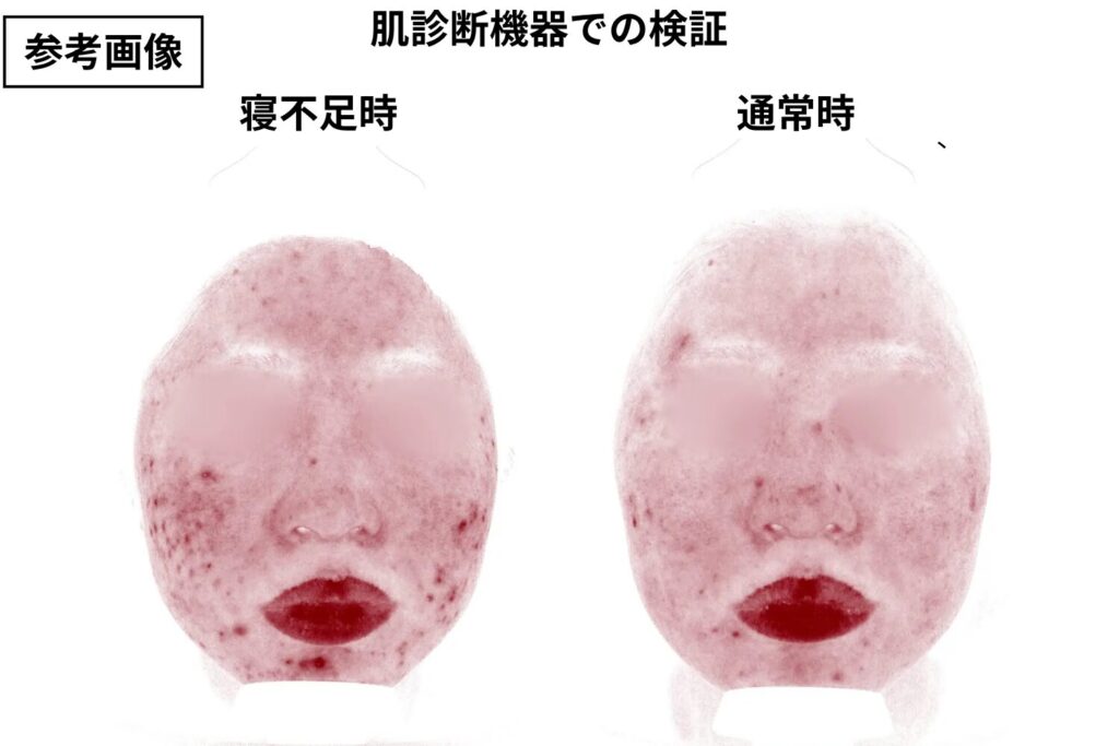 肌の免疫機能が低下する