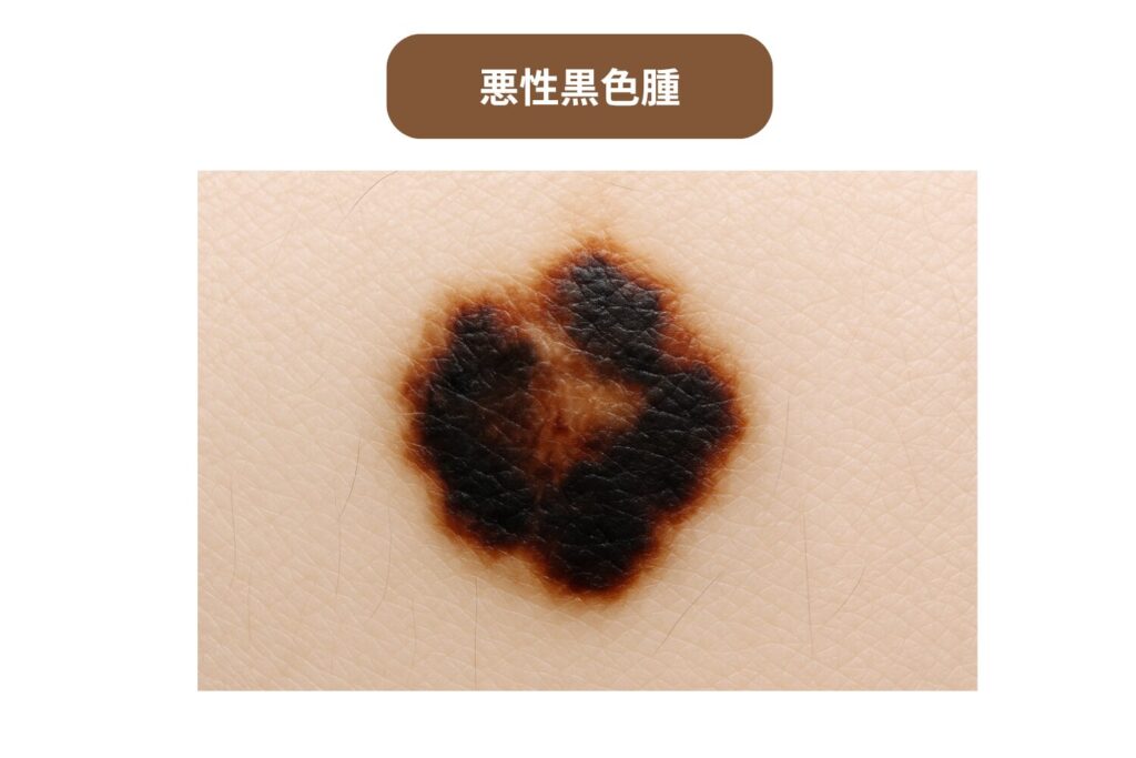 大きさ・色・形が変化してきた場合