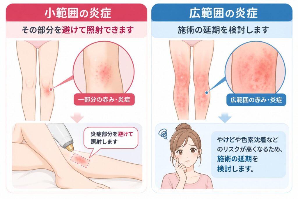 施術部位の肌トラブル(ニキビ・湿疹・傷)の有無
