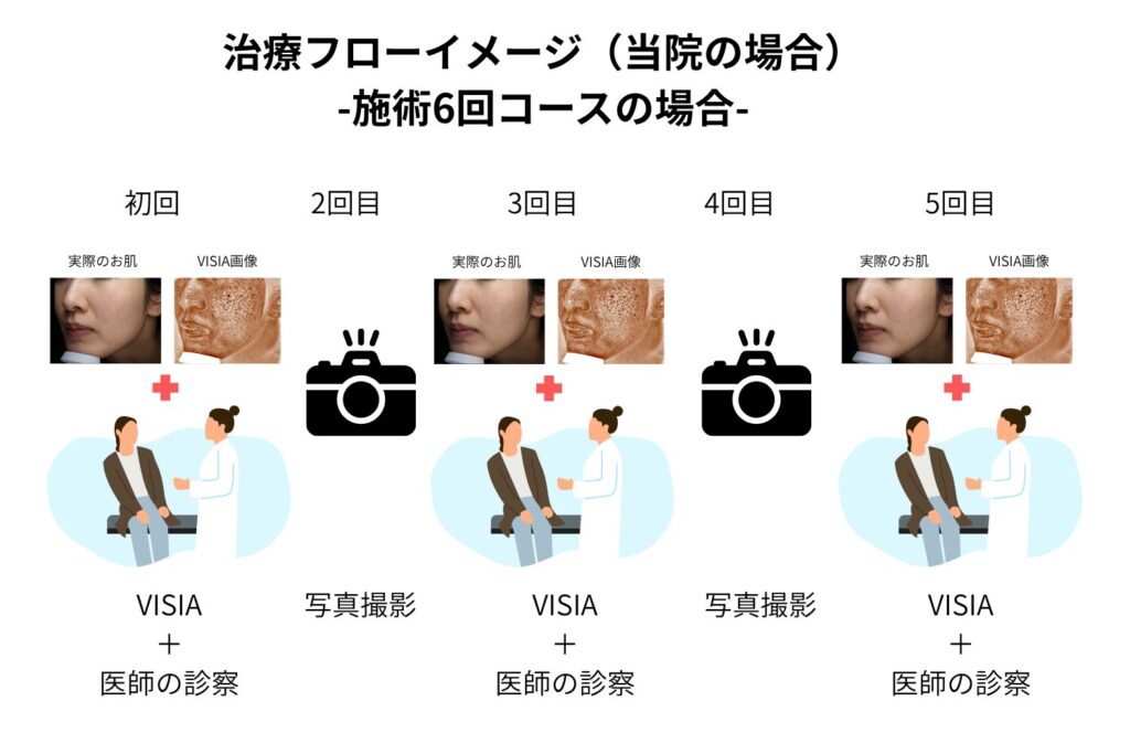 低出力で肌の変化を確認しながら照射する