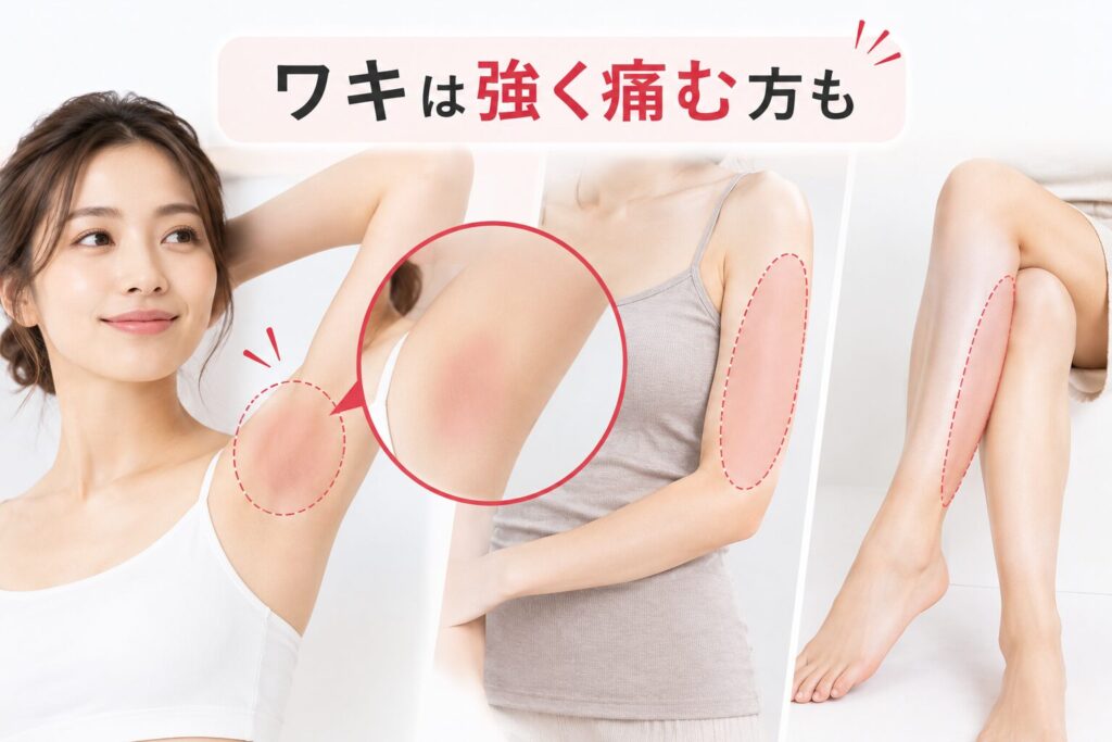 アレキサンドライト(755nm)で照射する部位:ワキ・腕・脚は耐えられる方が多い