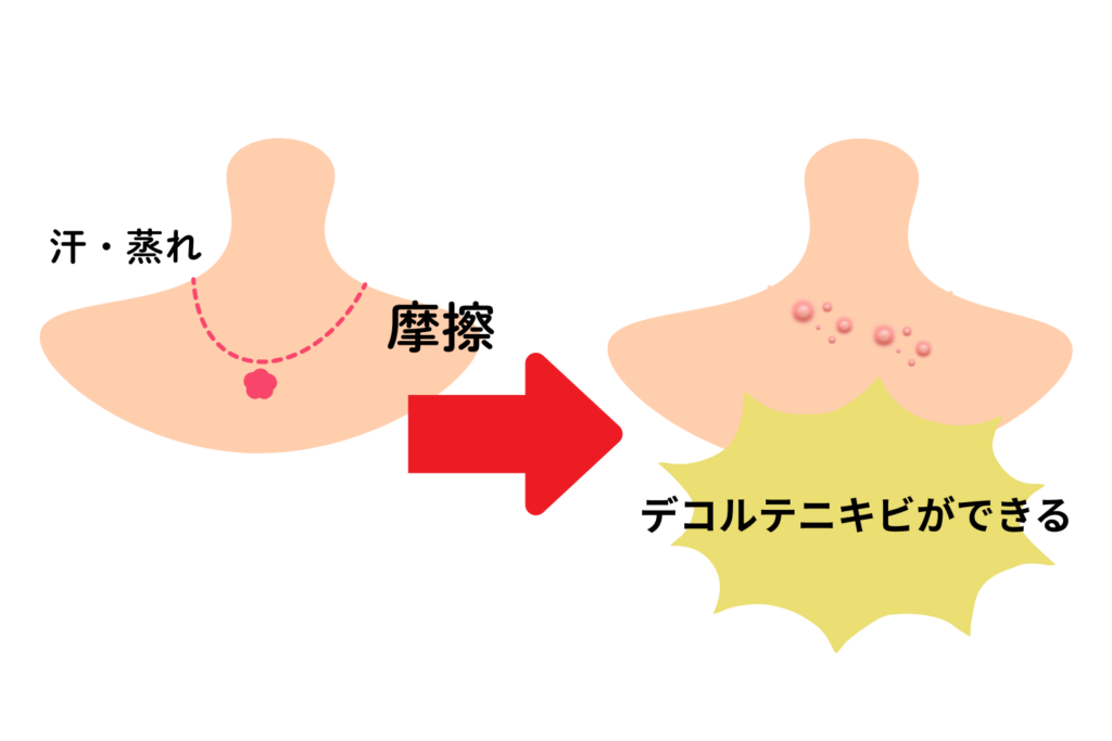 ネックレスやアクセサリーの金属刺激