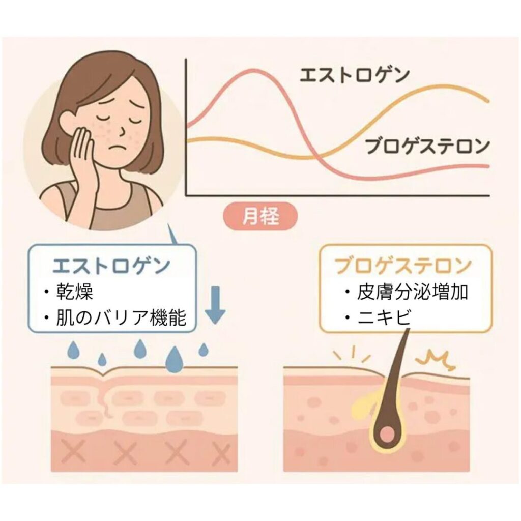出産後の女性ホルモンの変化で、皮脂と乾燥のバランスが乱れる