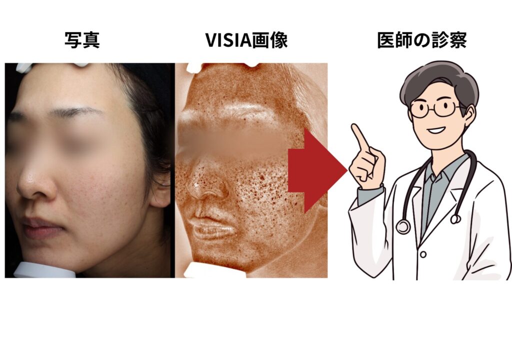 やめどきは診察・写真・VISIAで判断する