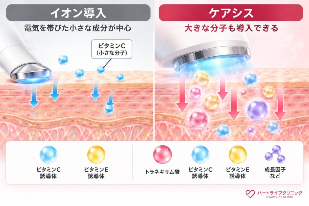 イオン導入では届きにくい大きな分子も導入できる