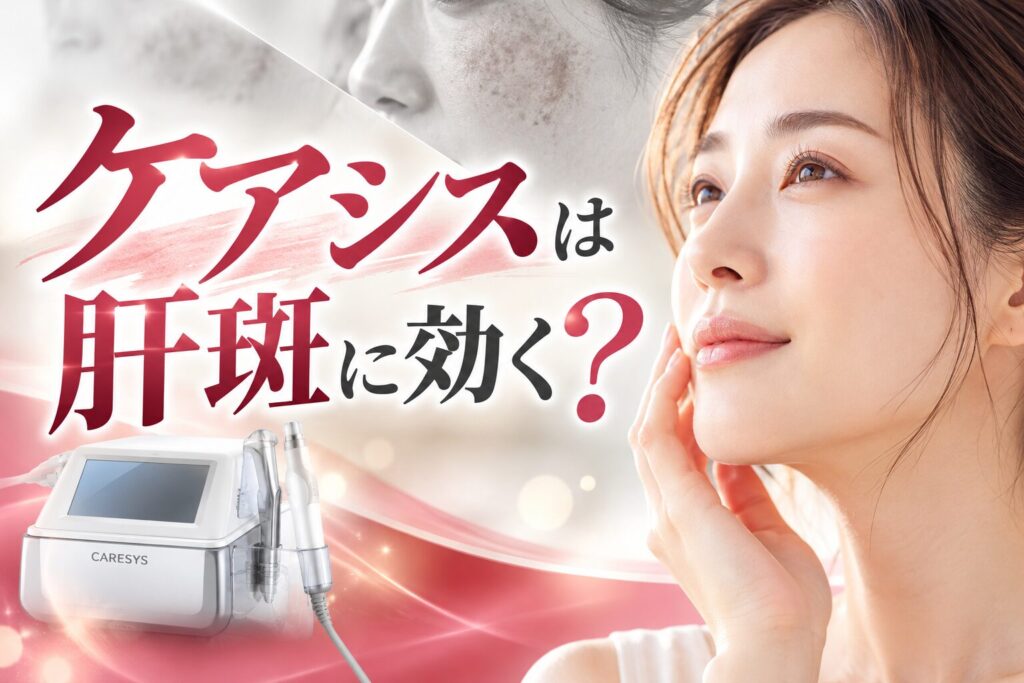 ケアシスは肝斑に効く?エレクトロポレーションで有効成分を届け...