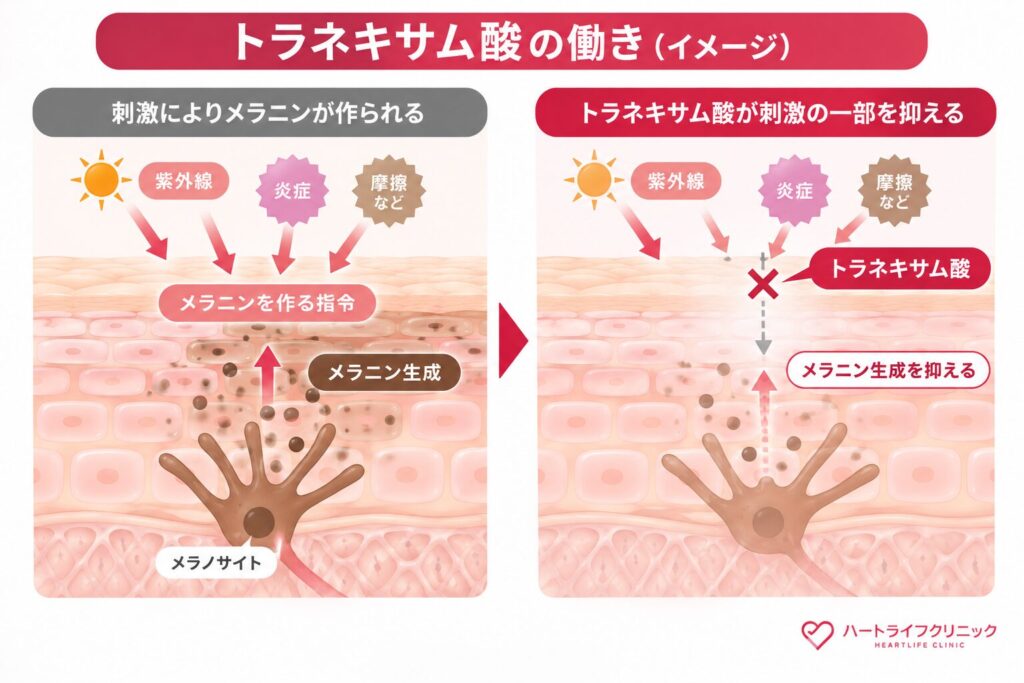 トラネキサム酸：メラニンを作る指令を止める