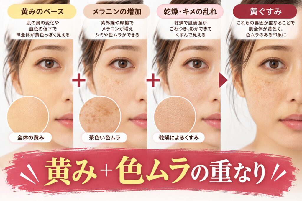 メラニンの増加と、血行などほかの要因との重なり