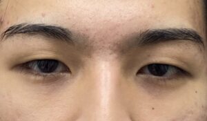 二重ビフォー