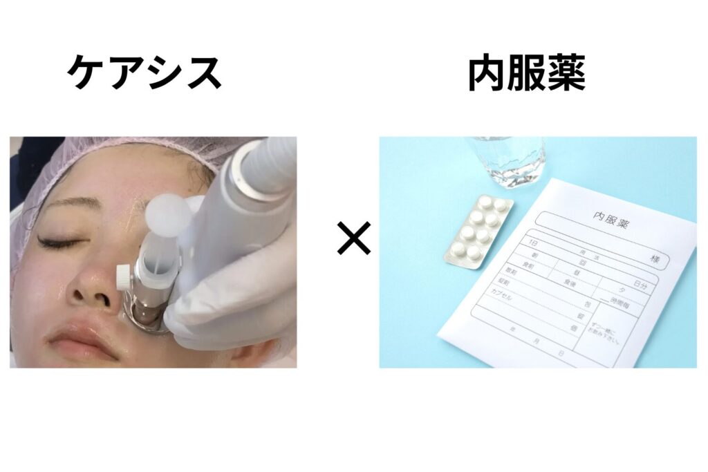 内服・外用＋ケアシス：刺激を避けたい人の基本形