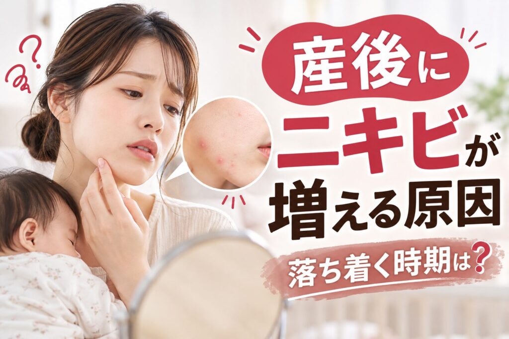 産後にニキビが増える原因と落ち着く時期|授乳中の注意点と相談...