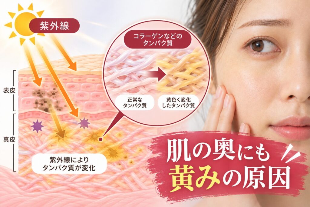 紫外線で起こる真皮の変色（カルボニル化）