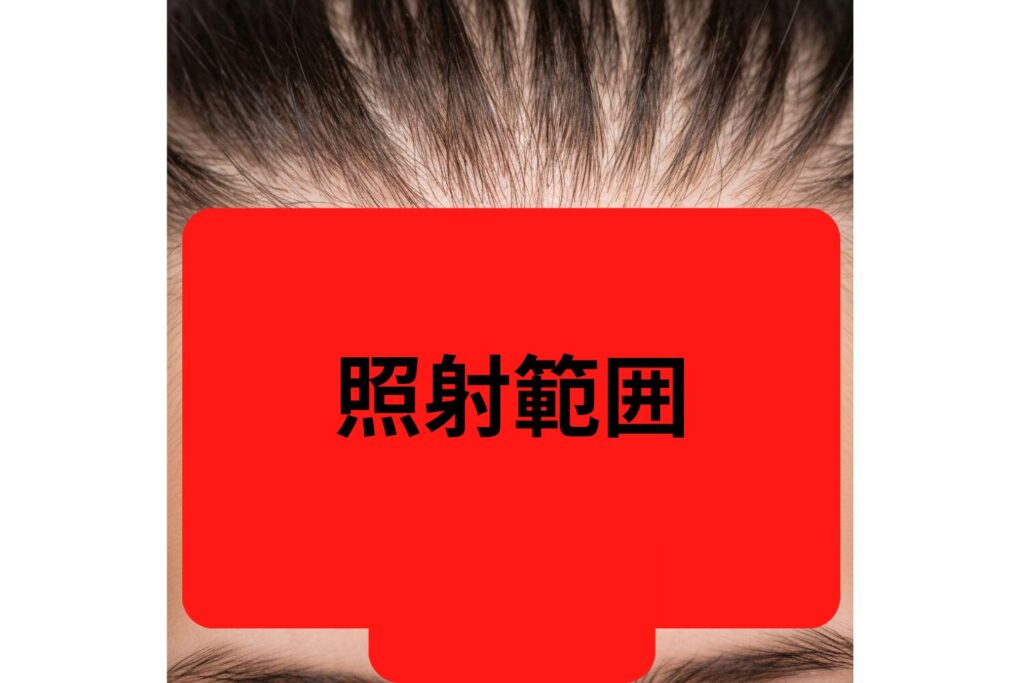 眉の上から生え際までが基本の範囲