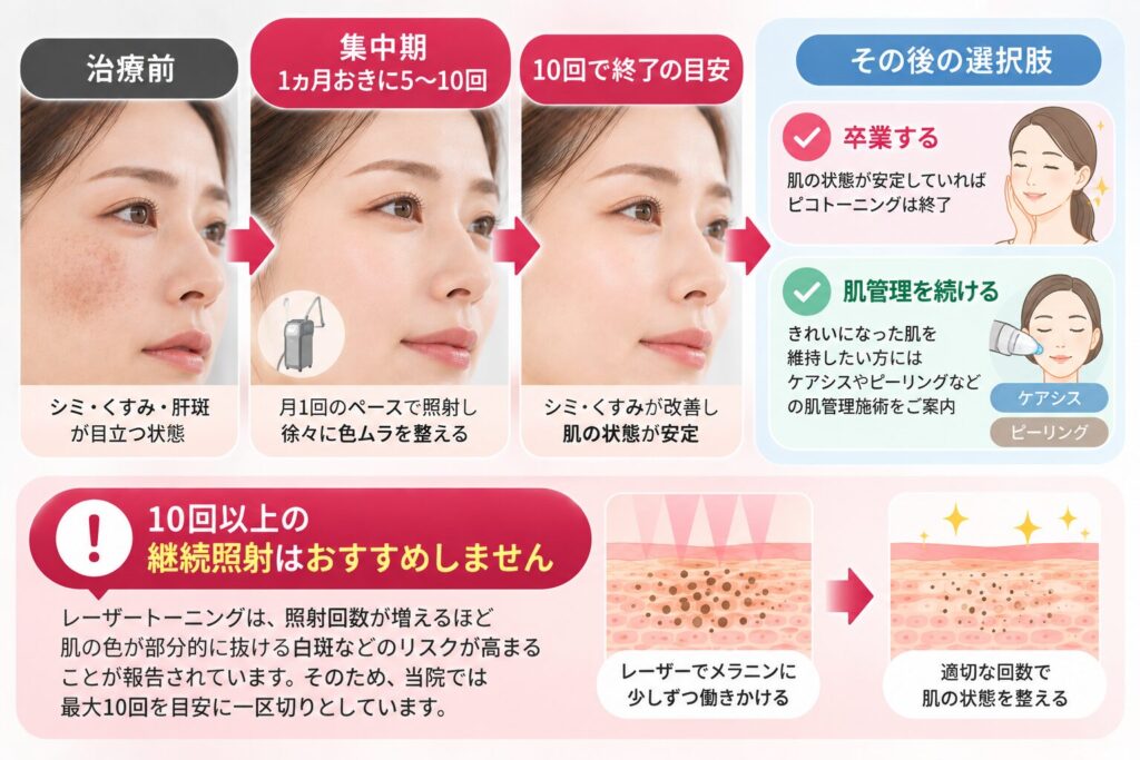 10回を目安に卒業または肌管理へ移行する